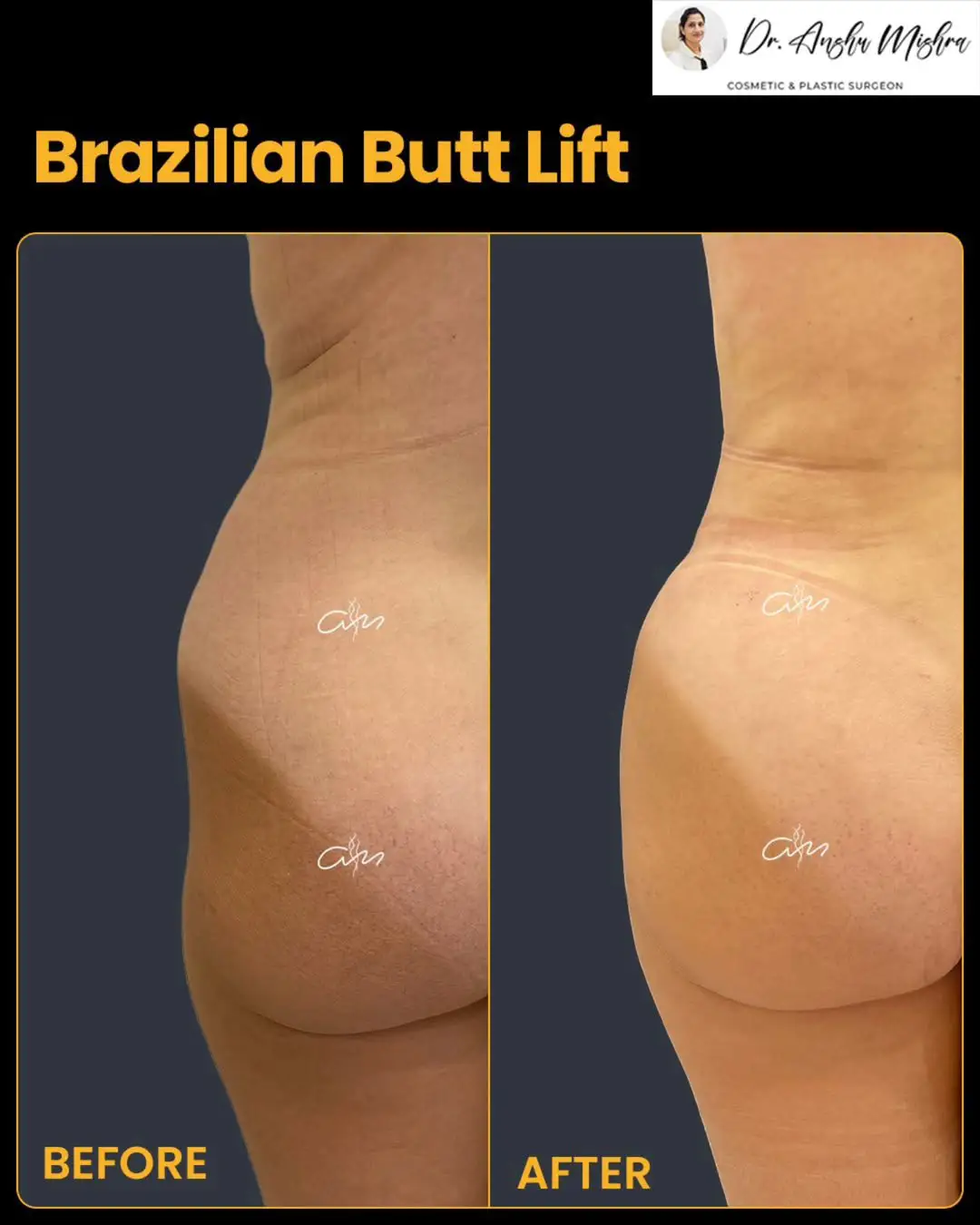 Before & After
