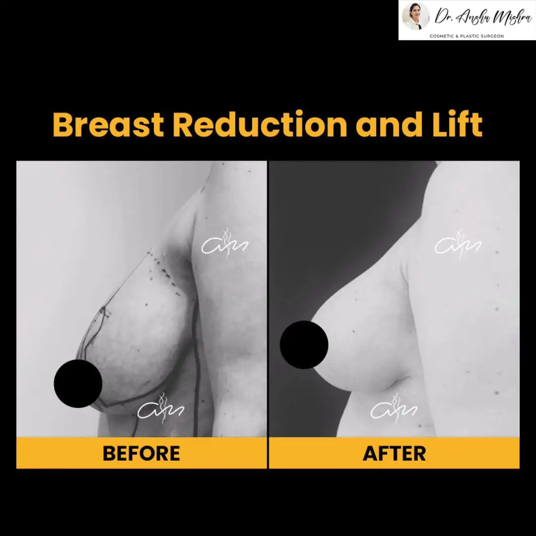 Before & After