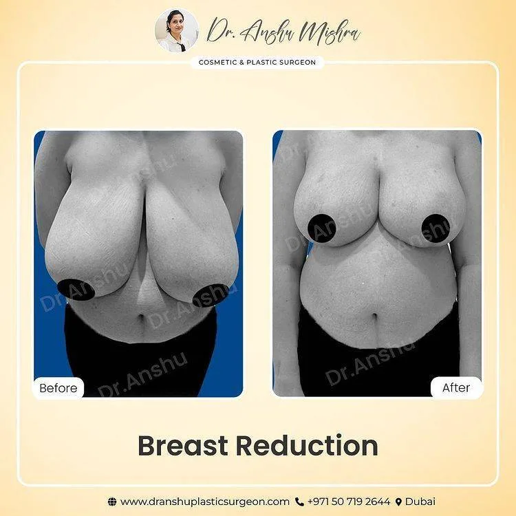 Before & After