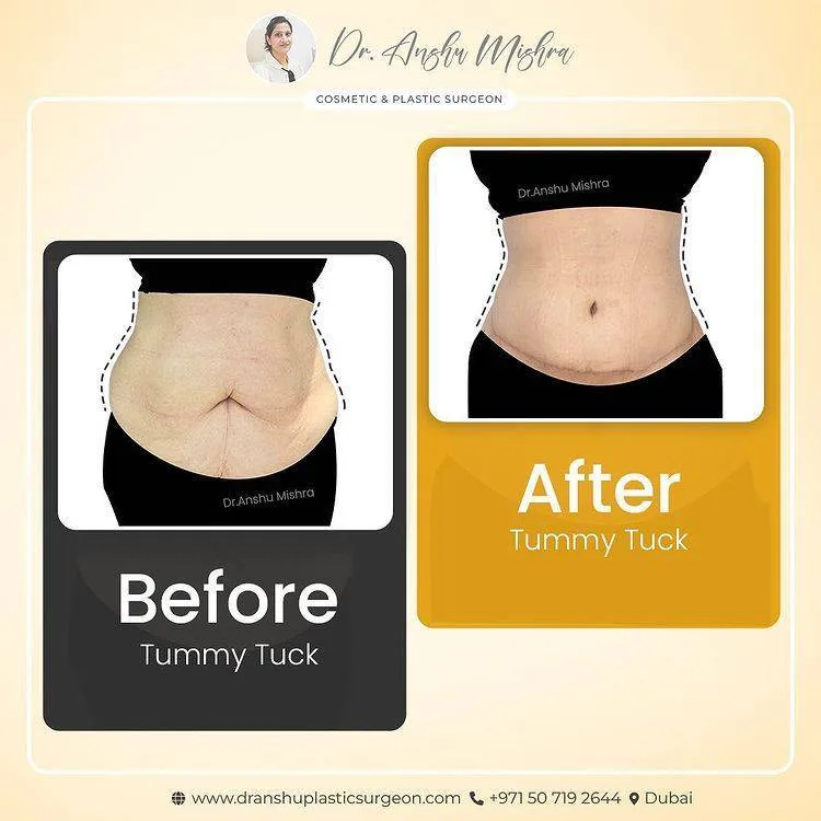 Before & After