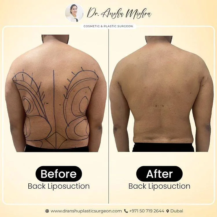 Before & After