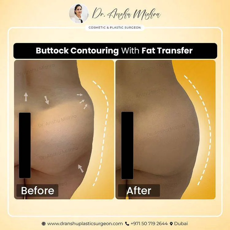 Before & After