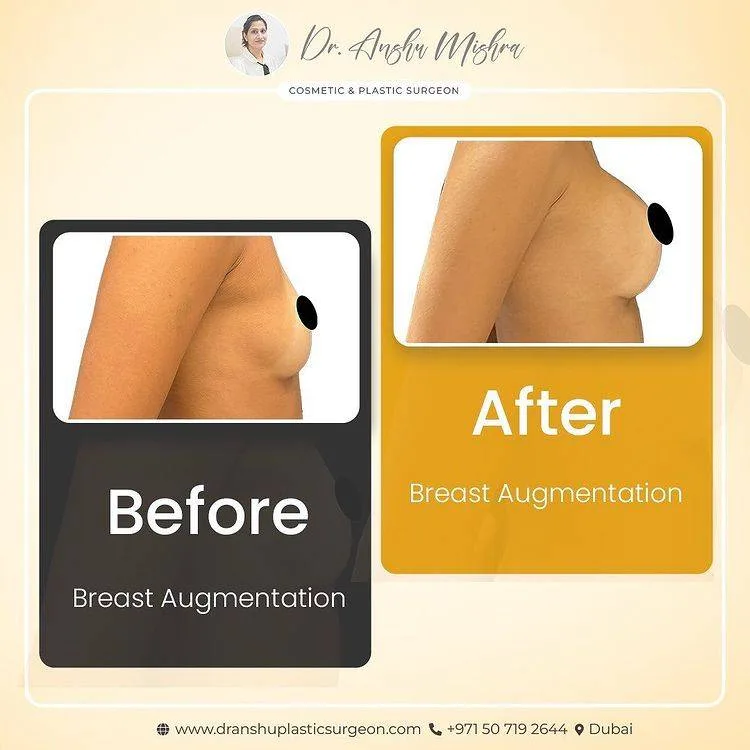 Before & After