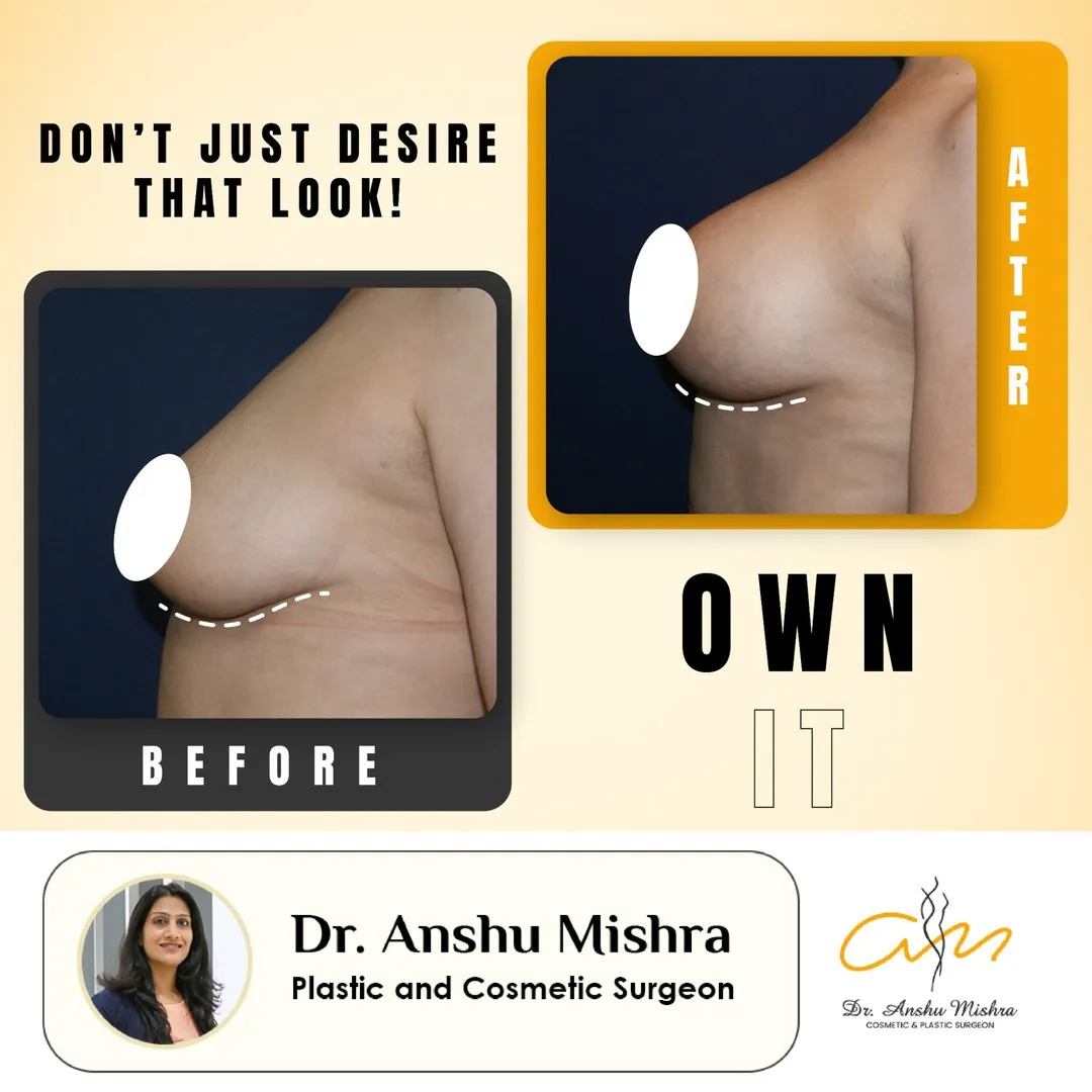 Before & After