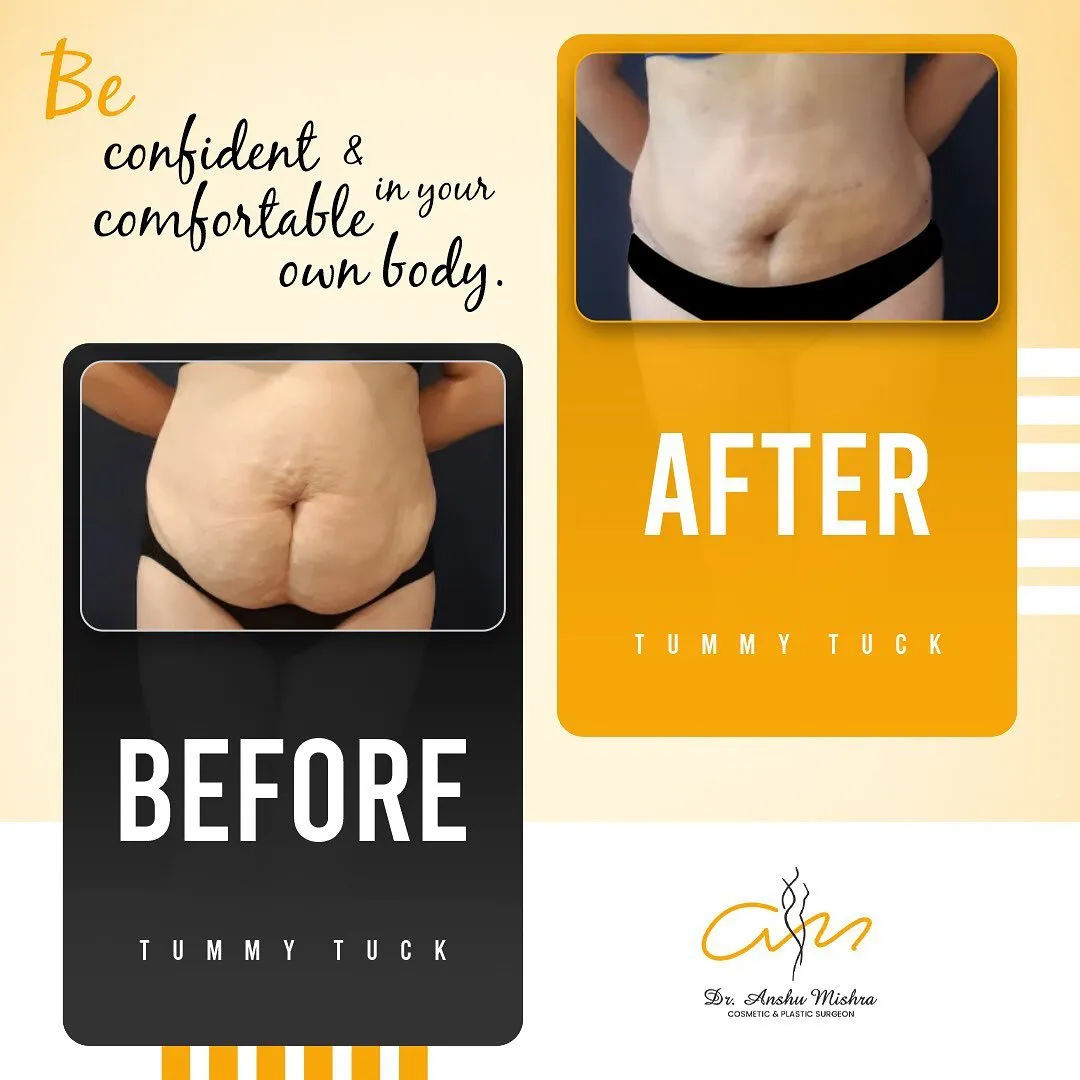 Before & After