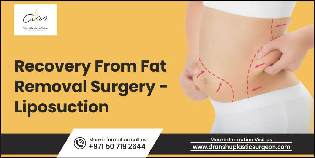Advantages of Liposuction