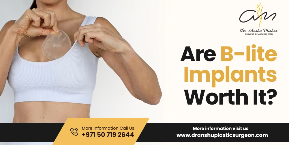 Are B-Lite Implants Worth It?
