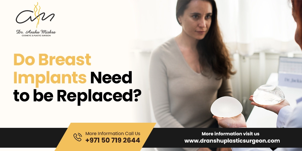 Do Breast Implants Need Replacement?