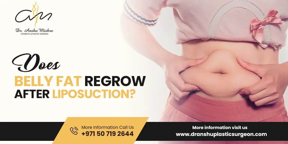 Does Belly Fat Regrow After Liposuction?