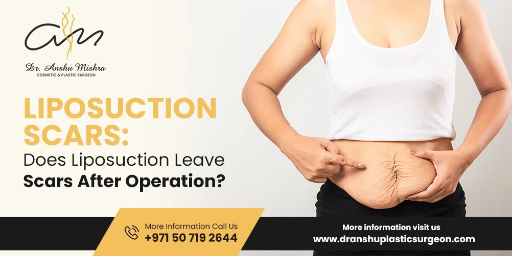 Liposuction Scars: Does Liposuction Leave Scars After Operation?
