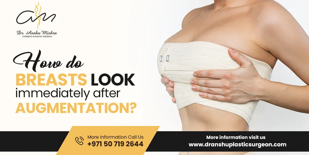 How Do Breasts Look Immediately After Augmentation?