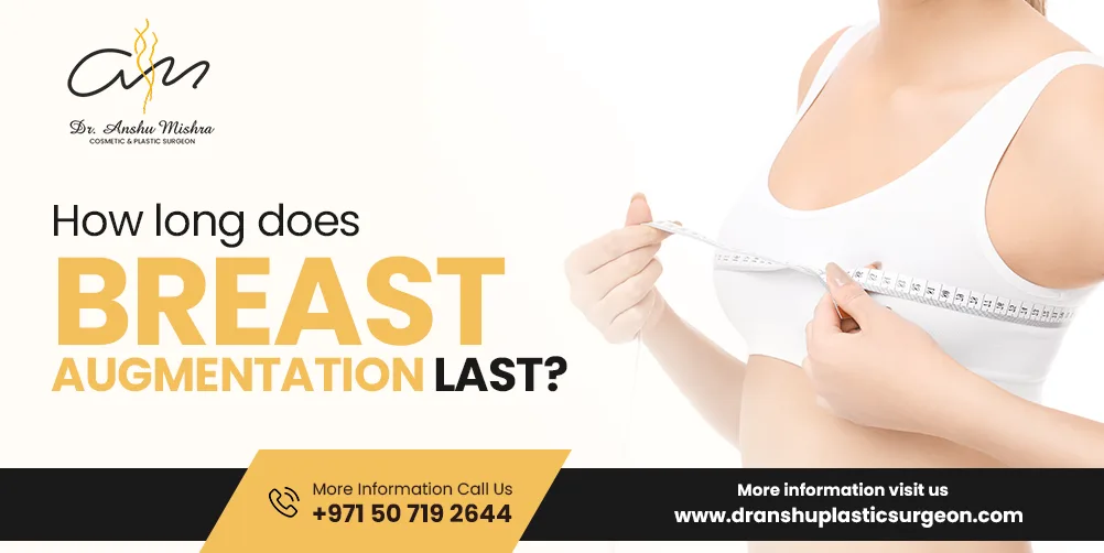 How Long Does Breast Augmentation Last? Check With Expert