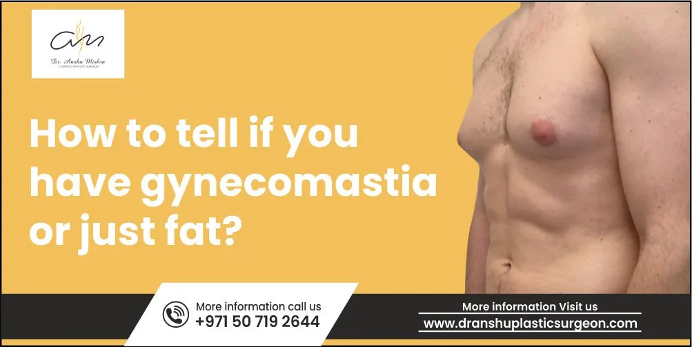 How to tell if you have Gynecomastia or Just fat?