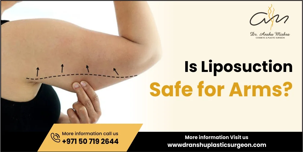 Is Liposuction Safe for Arms?