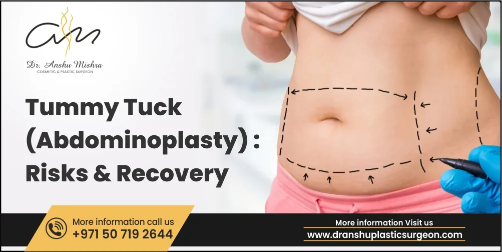 Tummy Tuck (Abdominoplasty): Risks & Recovery