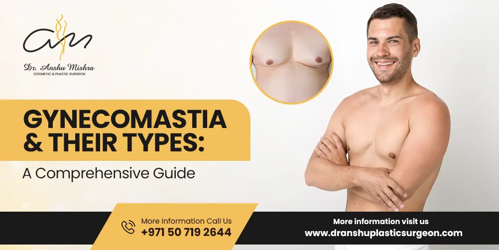 Gynecomastia & Their Types: A Comprehensive Guide