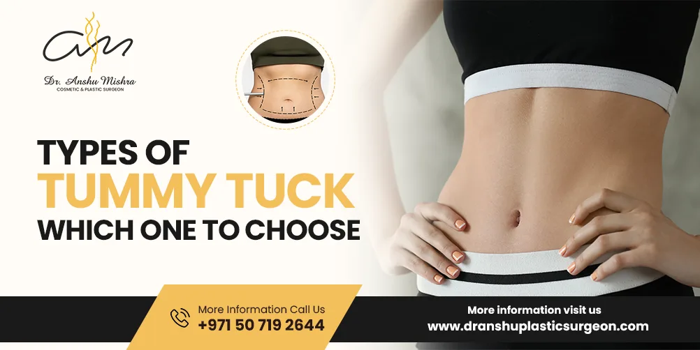 Types Of Tummy Tuck- Which One To Choose
