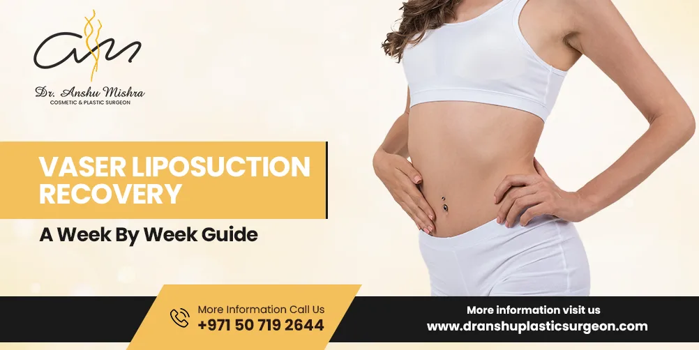 Vaser Liposuction Recovery- A Week By Week Guide