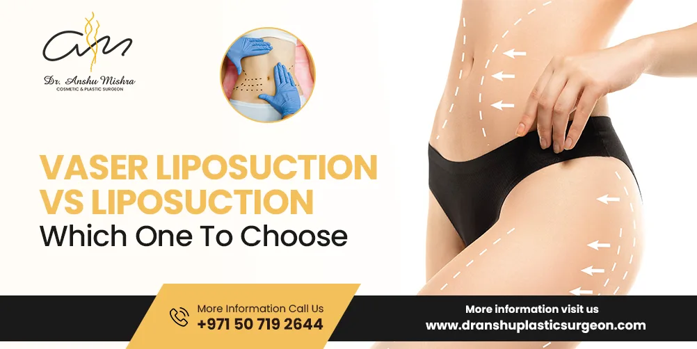 Vaser Liposuction Vs Liposuction- Which One To Choose