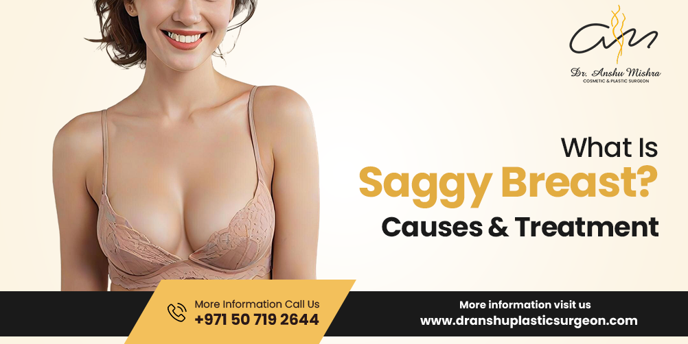 What Is Saggy Breast? – Causes & Treatment