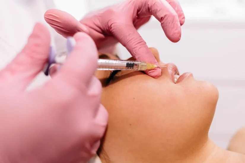 Lip Lift in Dubai