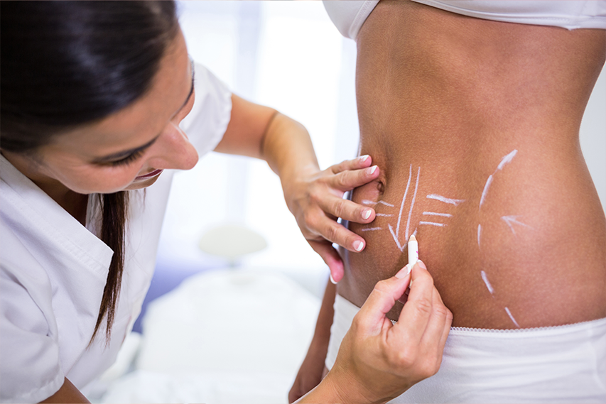 Liposuction In Dubai