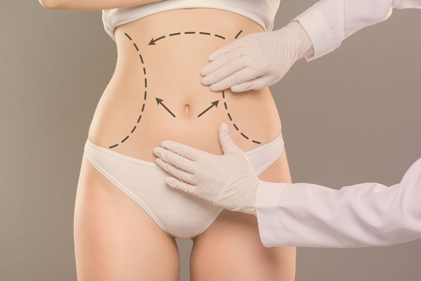Tummy Tuck Surgery In Dubai