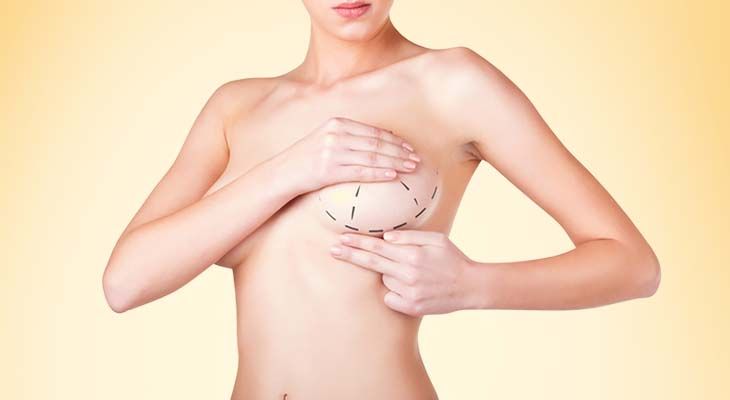 Breast Augmentation in Dubai