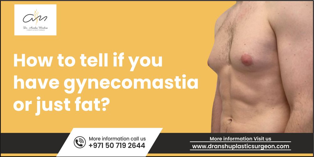 Gynecomastia vs. Chest Fat: Which One Do You Have?