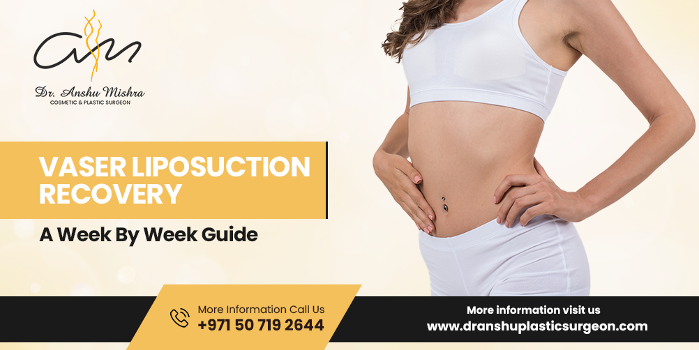 Vaser Liposuction recovery- week by week guide