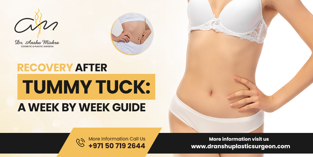 Recovery After Tummy Tuck