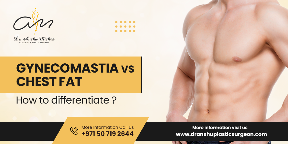 Gynecomastia Vs Chest Fat