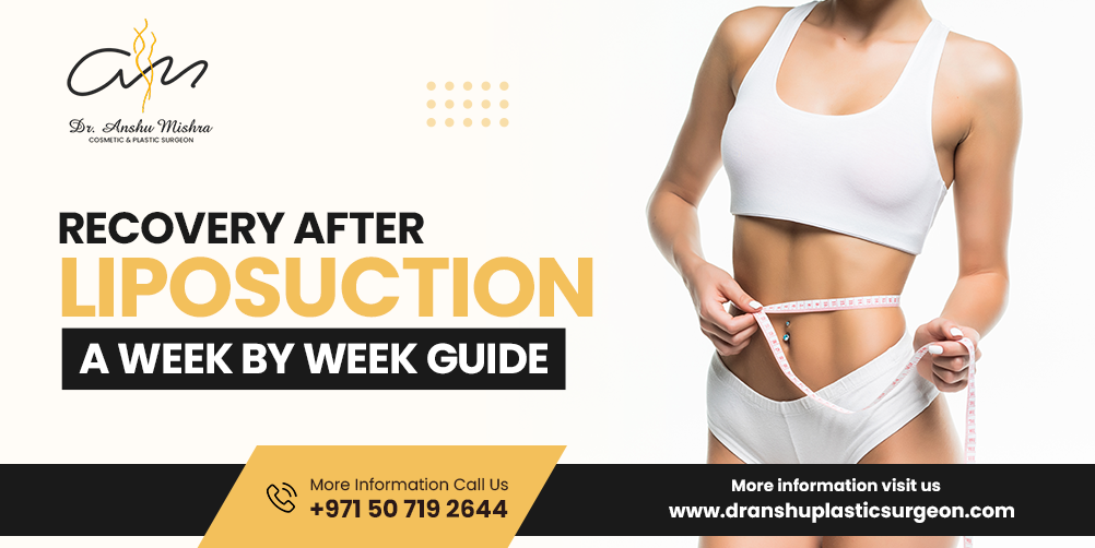 Recovery After Liposuction