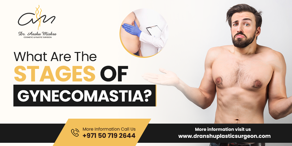 What Are The Stages Of Gynecomastia?