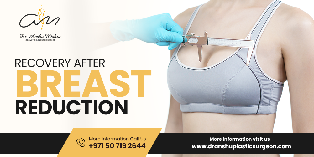 Recovery After Breast Reduction