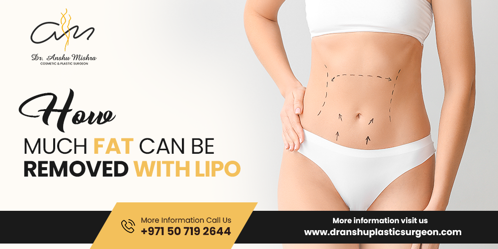 How Much Fat Can Be Removed with Lipo